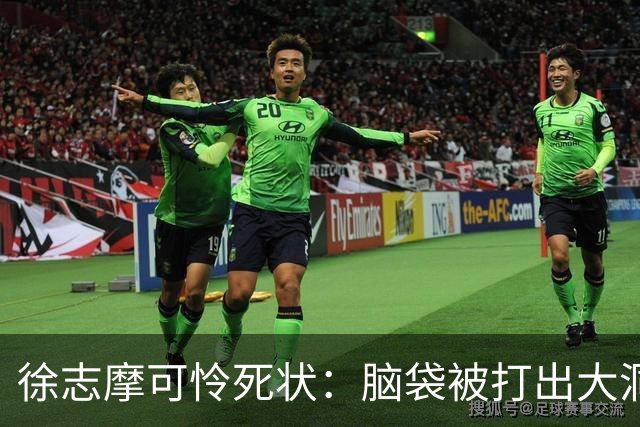 徐志摩可怜死状：脑袋被打出大洞，四肢被烈火炙烤成焦炭！
